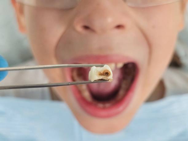 Best Emergency Treatment for Oral Infections in Atwood, KS