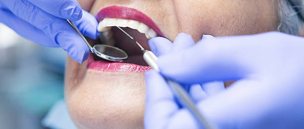 Best Emergency Wisdom Tooth Extraction in Atwood, KS